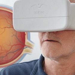 L'écosystème Viewi aide à diagnostiquer le glaucome avec un smartphone Diagnostiquer le glaucome avec l'écosystème Viewi