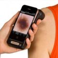 Problmes de peau : un procd de dtection bientt disponible sur les smartphones