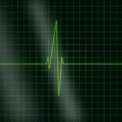 Smartphone aide au dpistage d'une maladie cardiaque